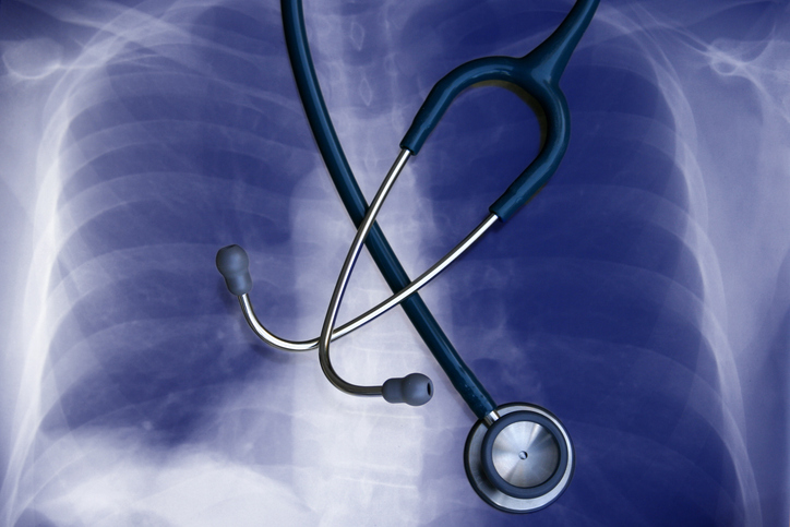 Photo of lung with stethoscope