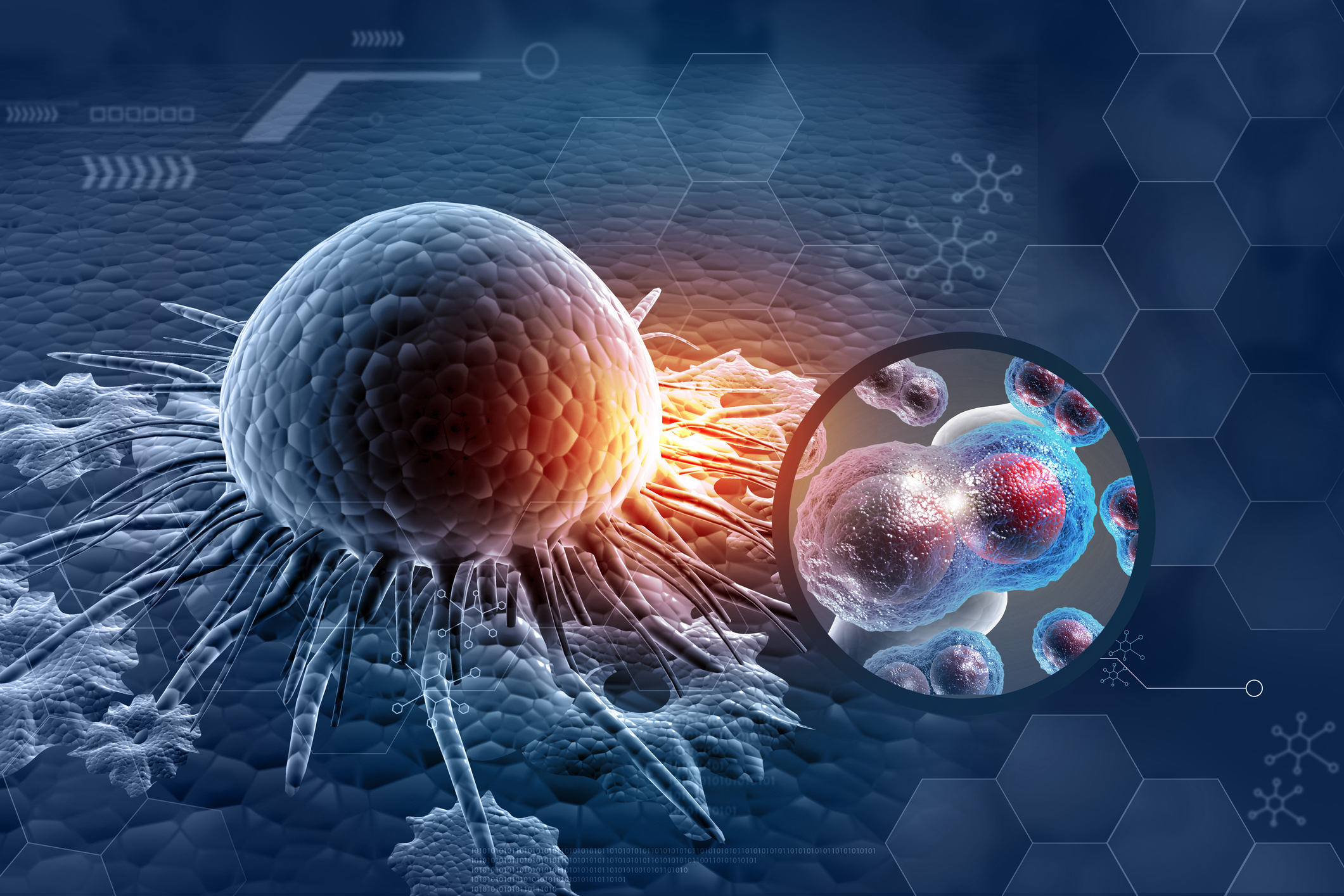 Microscope image of blue tumor cells