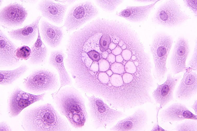 HPV-oncoprotein