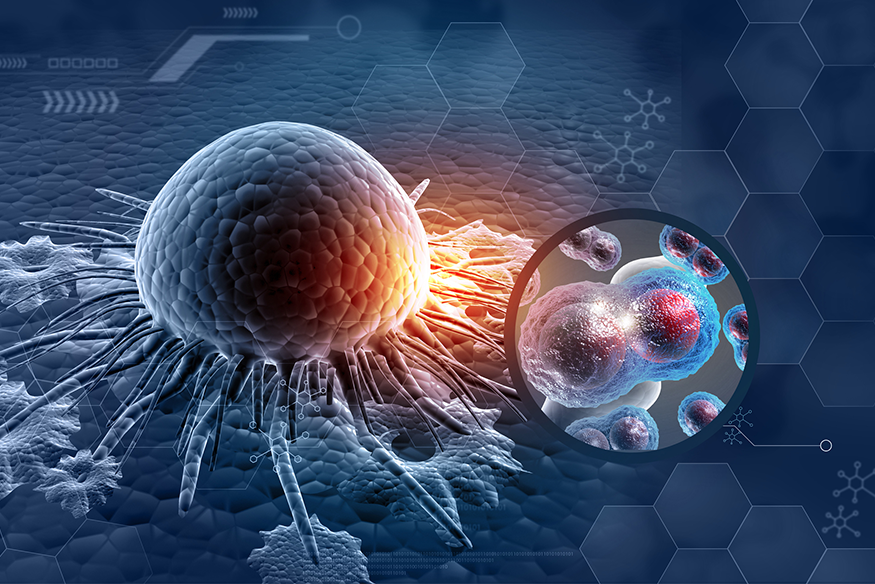 Graphic of blue tumor cell