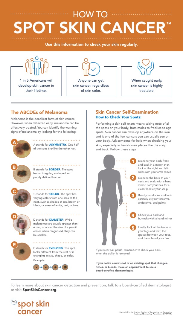 How to spot skin cancer graphic
