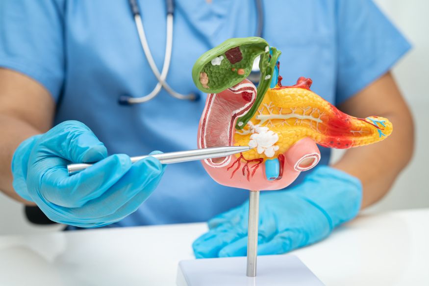 Close-up of a person in medical scrubs and blue gloves using a silver pointer tool to indicate a specific section on an anatomical model of a pancreas, gallbladder, and duodenum.