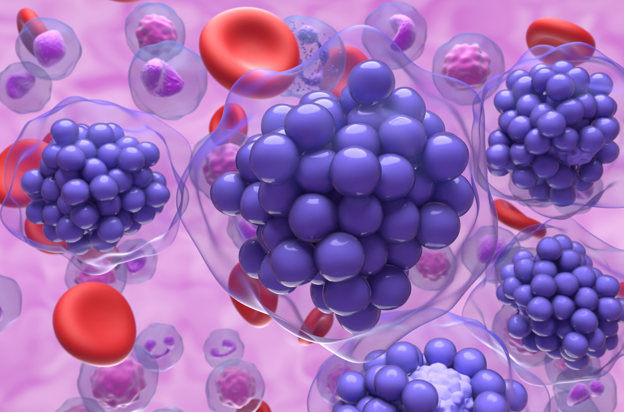 A 3D medical illustration depicting a cluster of large, purple, spherical cancer cells representing B-cell lymphoma.