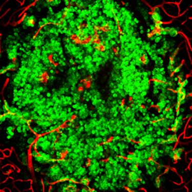 CancerCellsCNIORelease