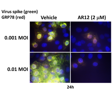 Image the effect of the drug AR-12 on the SARS-Cov2 virus