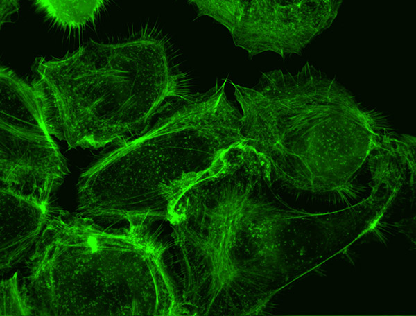 HPVOncoproteinRS