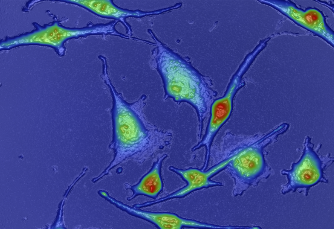 HSLCIMelanomaCellGraphic