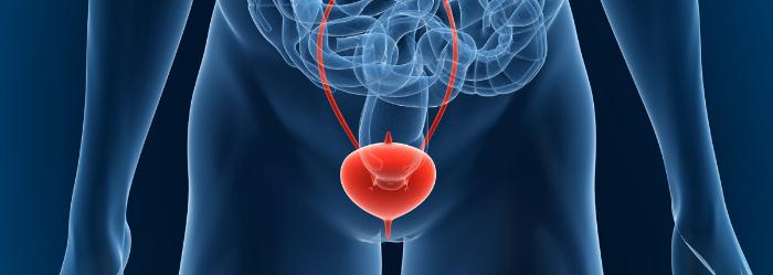bladder-cancer-1-700x249