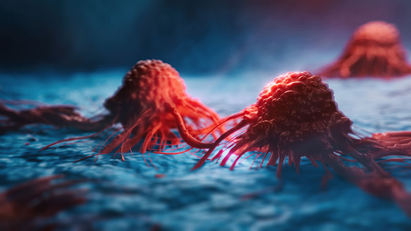 Cancer image