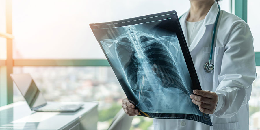 Image of doctor holding x-ray