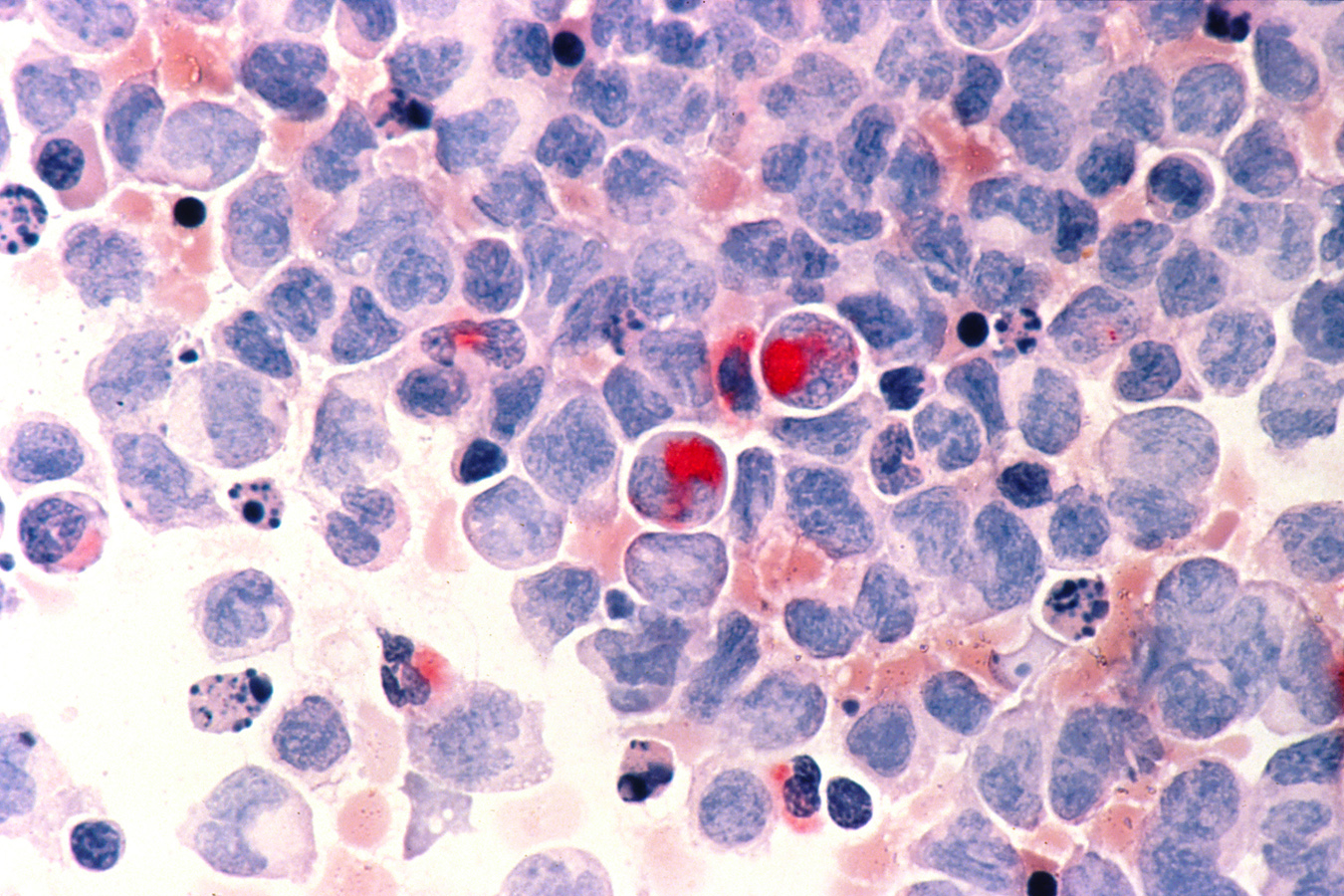 nci-vol-2336-150