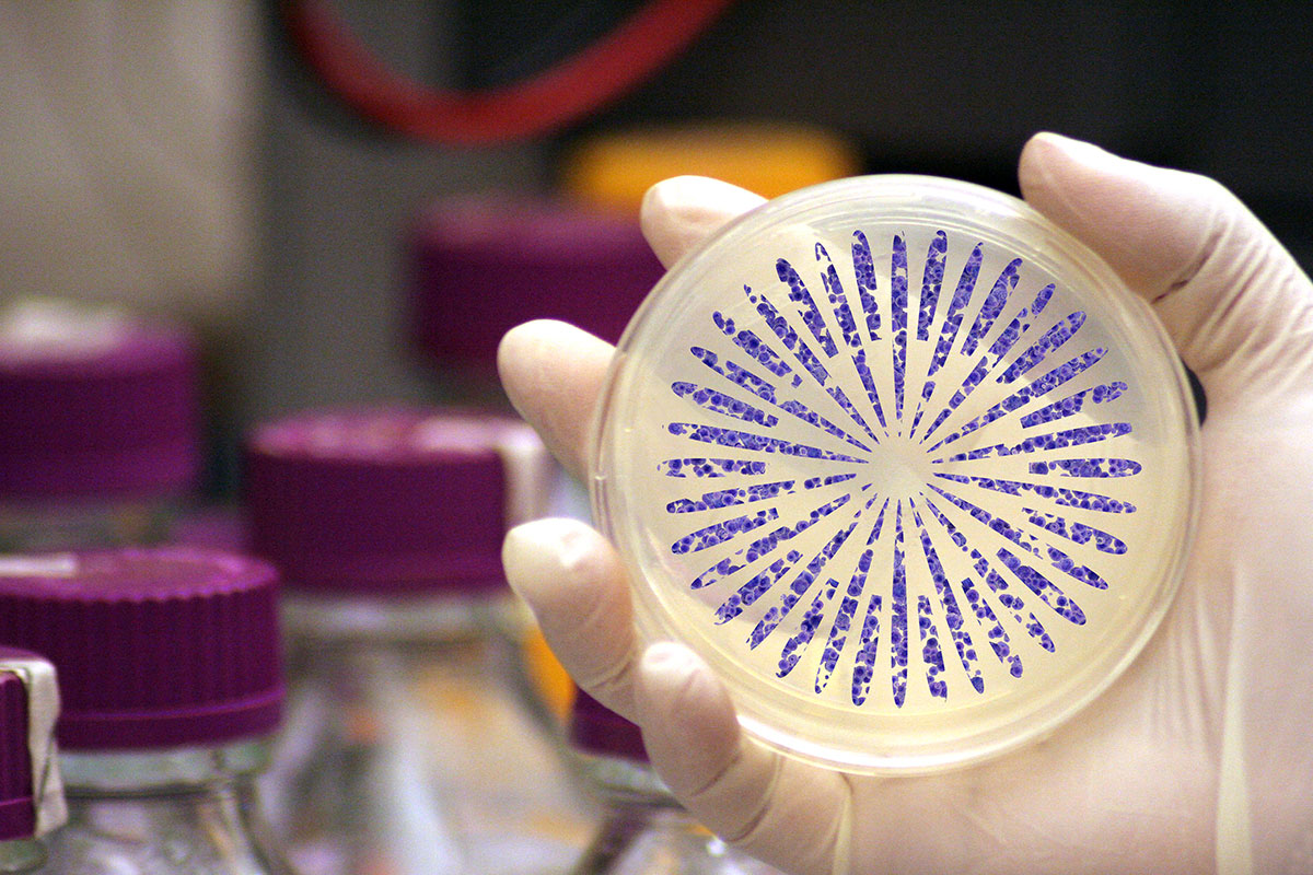 Image of petri dish with Massey burst